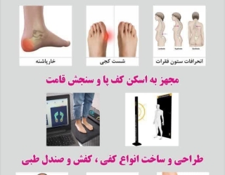 تخصصی ترین کلینیک غیرجراحی زانو ضربدری/ زانوپرانتزی سعادت آباد/غرب تهران