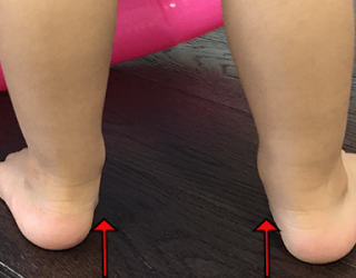 toddler-with-flat-feet